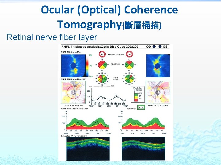 Ocular (Optical) Coherence Tomography(斷層掃描) Retinal nerve fiber layer 