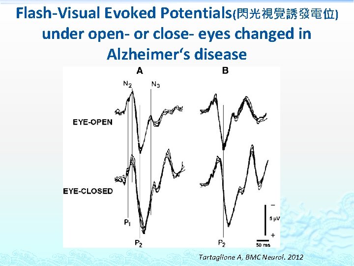 Flash-Visual Evoked Potentials(閃光視覺誘發電位) under open- or close- eyes changed in Alzheimer‘s disease Tartaglione A,