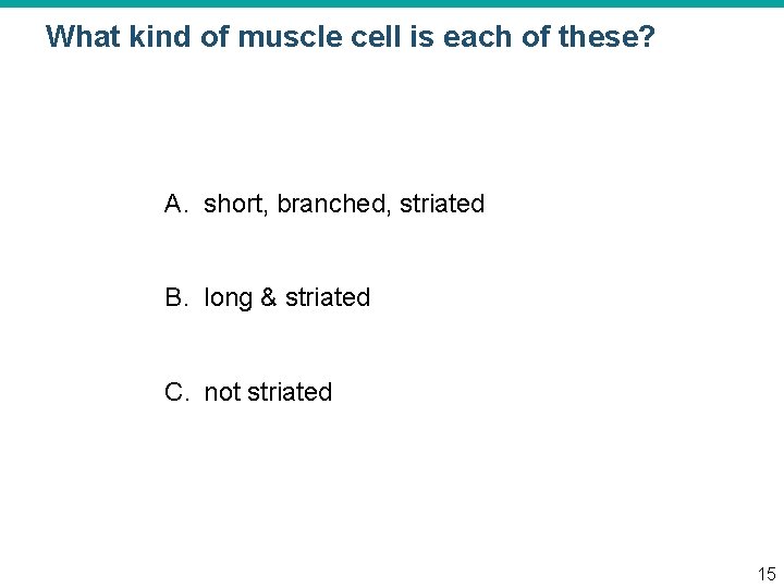 What kind of muscle cell is each of these? A. short, branched, striated B.