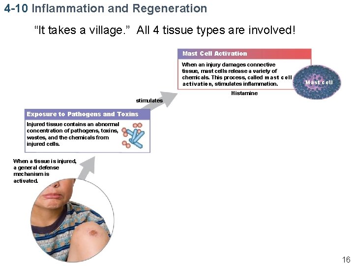 4 -10 Inflammation and Regeneration “It takes a village. ” All 4 tissue types