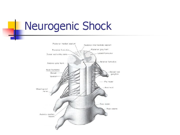 Neurogenic Shock 