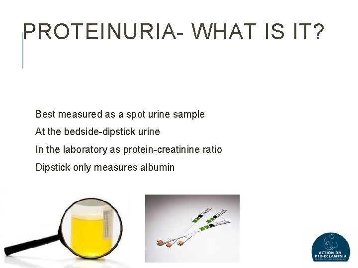 PROTEINURIA- WHAT IS IT? Best measured as a spot urine sample At the bedside-dipstick