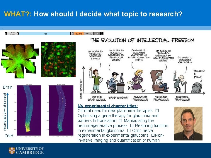 WHAT? : How should I decide what topic to research? Anterograde axonal transport Brain