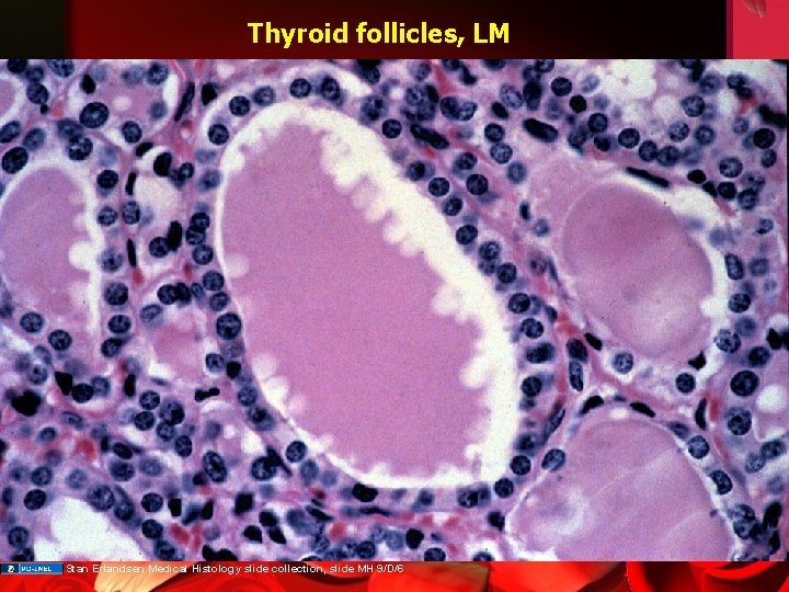 Thyroid follicles, LM Stan Erlandsen Medical Histology slide collection, slide MH 9/D/6 