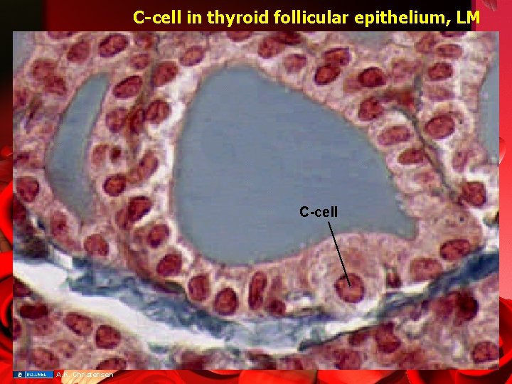 C-cell in thyroid follicular epithelium, LM C-cell A. K. Christensen 