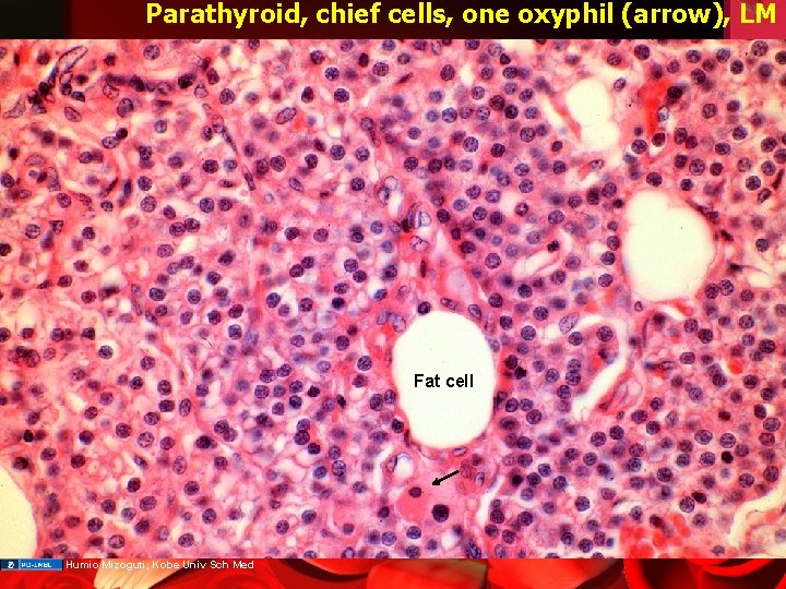 Parathyroid, chief cells, one oxyphil (arrow), LM Fat cell Humio Mizoguti, Kobe Univ Sch