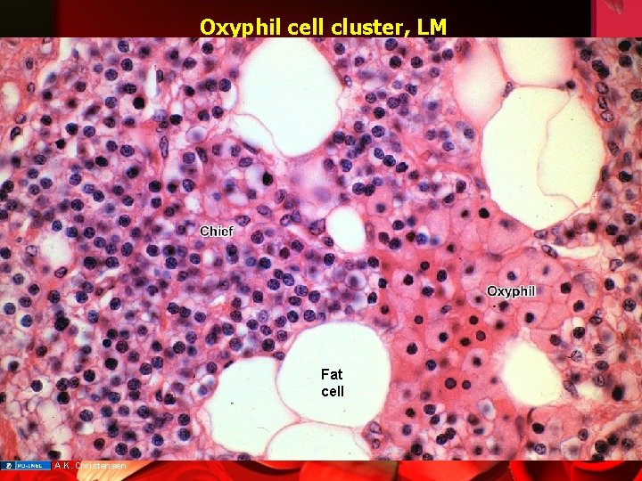 Oxyphil cell cluster, LM Fat cell A. K. Christensen 