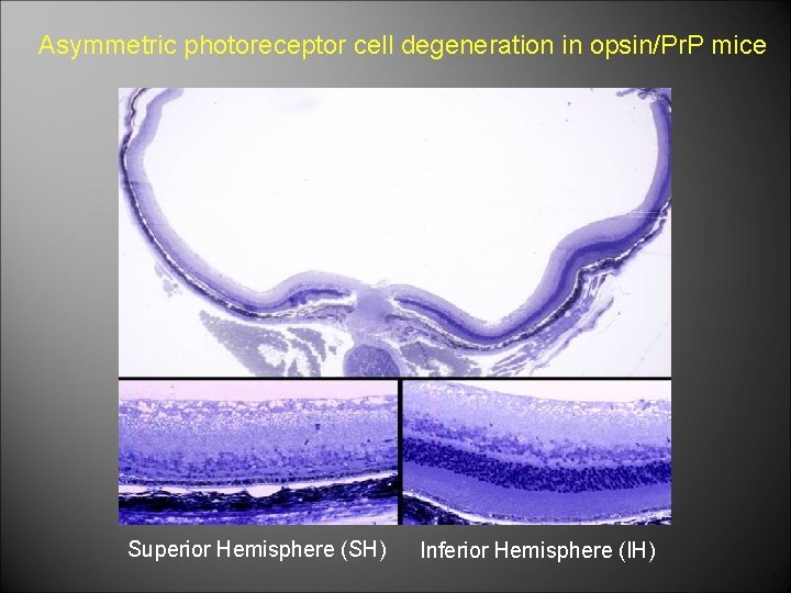 Asymmetric photoreceptor cell degeneration in opsin/Pr. P mice Superior Hemisphere (SH) Inferior Hemisphere (IH)