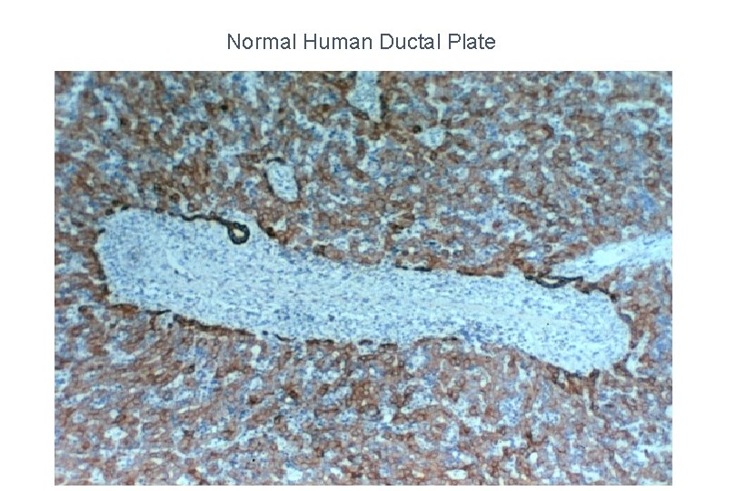 Normal Human Ductal Plate 
