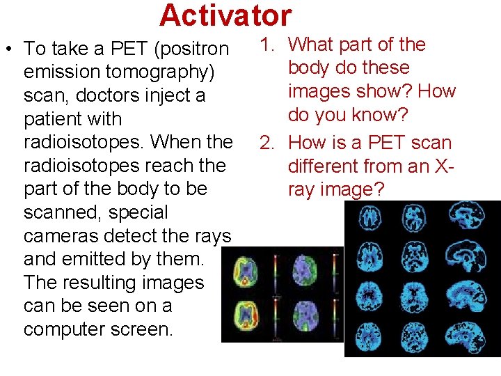 Activator • To take a PET (positron emission tomography) scan, doctors inject a patient