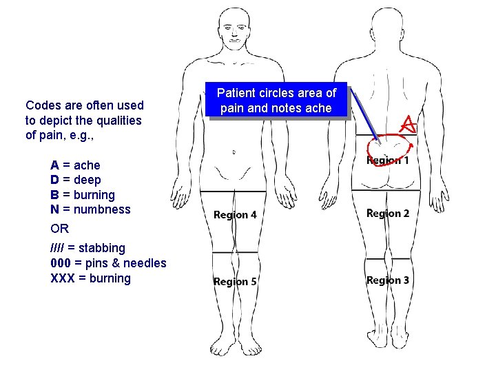 Pain drawings (cont. ) Codes are often used to depict the qualities of pain,