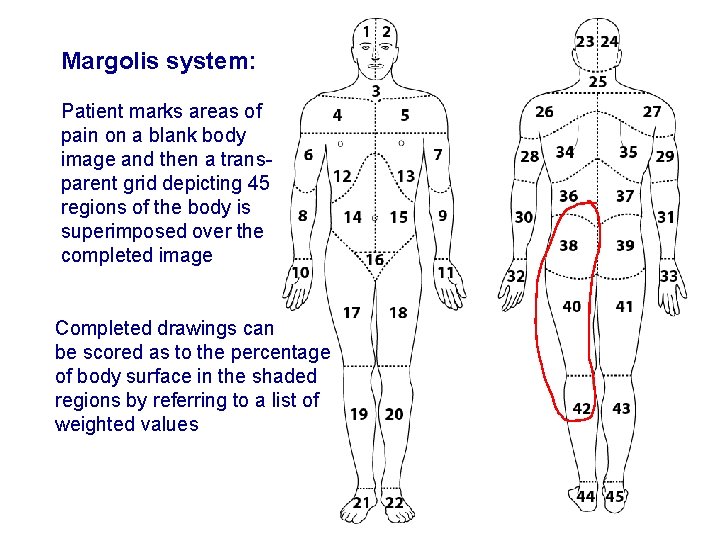 Margolis system: Patient marks areas of pain on a blank body image and then