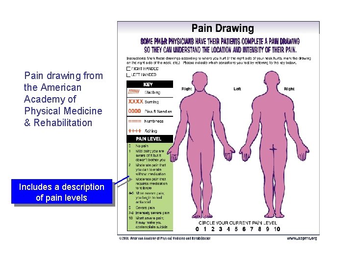 Pain drawing from the American Academy of Physical Medicine & Rehabilitation Includes a description