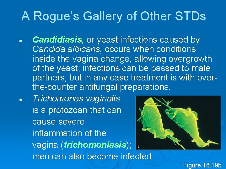 A Rogue’s Gallery of Other STDs l l Candidiasis, or yeast infections caused by