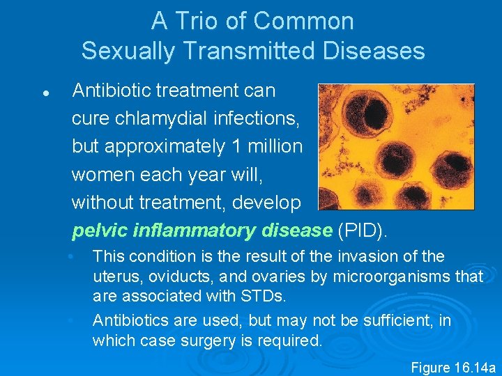 A Trio of Common Sexually Transmitted Diseases l Antibiotic treatment can cure chlamydial infections,