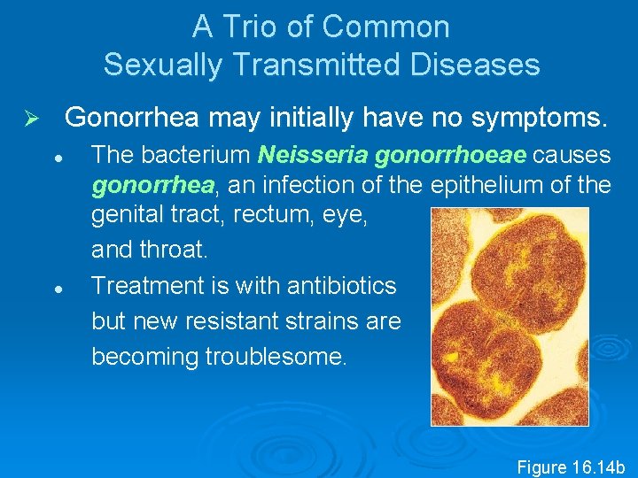 A Trio of Common Sexually Transmitted Diseases Gonorrhea may initially have no symptoms. Ø