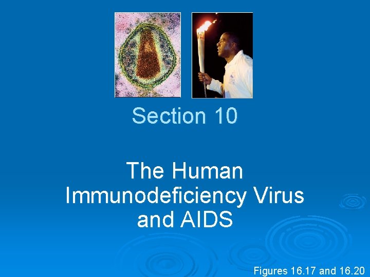 Section 10 The Human Immunodeficiency Virus and AIDS Figures 16. 17 and 16. 20