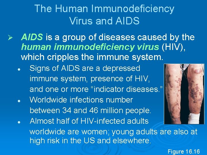 The Human Immunodeficiency Virus and AIDS is a group of diseases caused by the