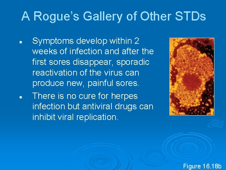 A Rogue’s Gallery of Other STDs l l Symptoms develop within 2 weeks of
