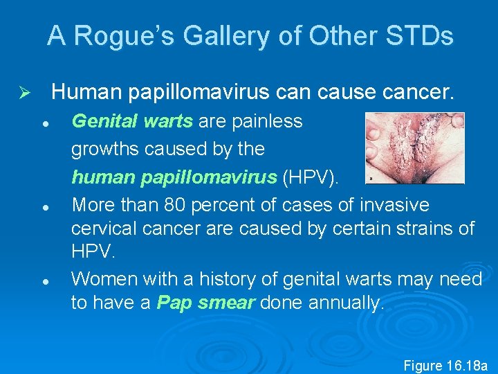 A Rogue’s Gallery of Other STDs Human papillomavirus can cause cancer. Ø l l