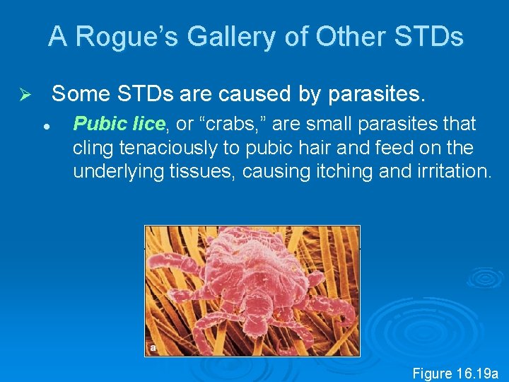 A Rogue’s Gallery of Other STDs Some STDs are caused by parasites. Ø l