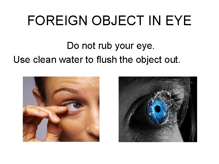 FOREIGN OBJECT IN EYE Do not rub your eye. Use clean water to flush