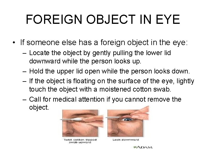 FOREIGN OBJECT IN EYE • If someone else has a foreign object in the