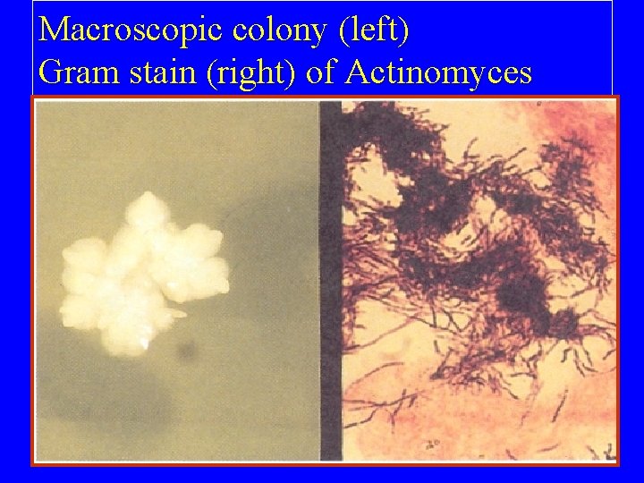 Macroscopic colony (left) Gram stain (right) of Actinomyces 