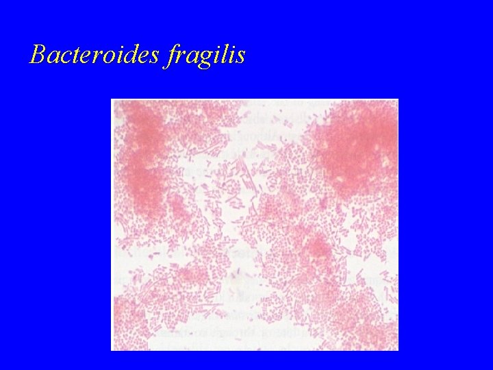 Bacteroides fragilis 