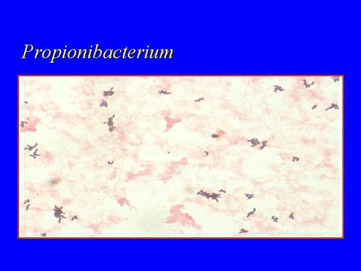 Propionibacterium 
