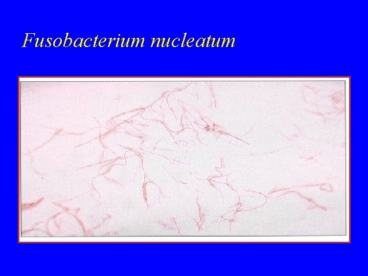 Fusobacterium nucleatum 