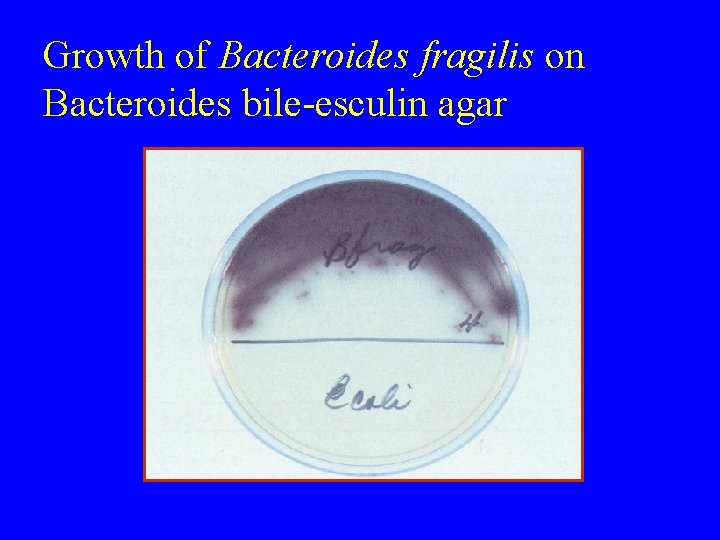 Growth of Bacteroides fragilis on Bacteroides bile-esculin agar 