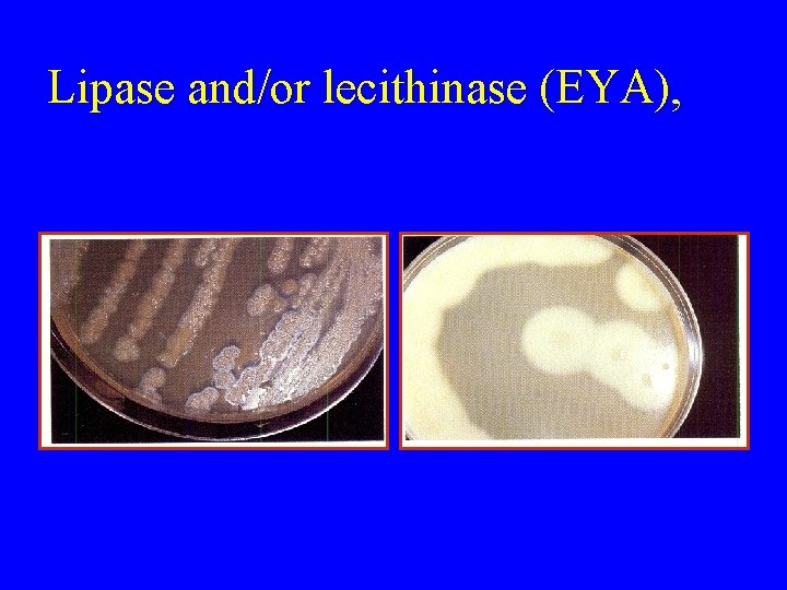 Lipase and/or lecithinase (EYA), 