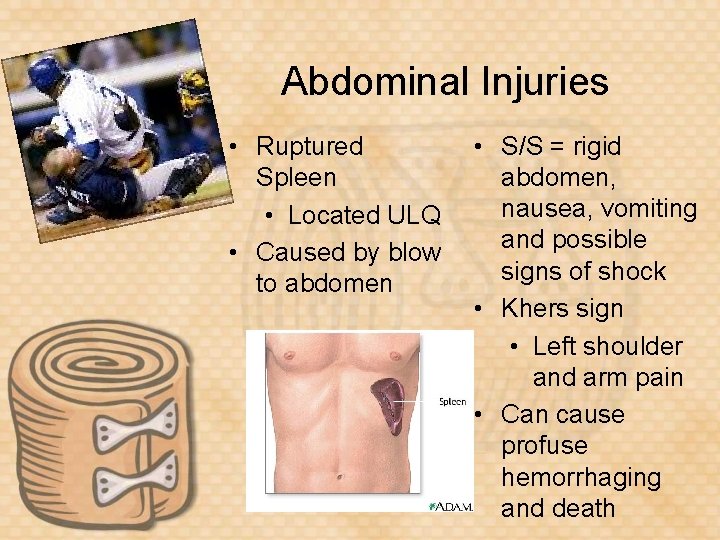 Abdominal Injuries • Ruptured Spleen • Located ULQ • Caused by blow to abdomen
