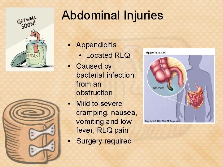 Abdominal Injuries • Appendicitis • Located RLQ • Caused by bacterial infection from an