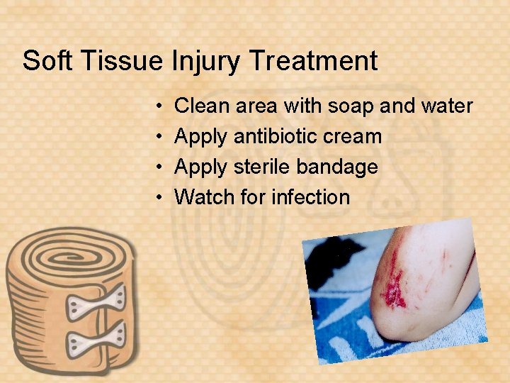 Soft Tissue Injury Treatment • • Clean area with soap and water Apply antibiotic