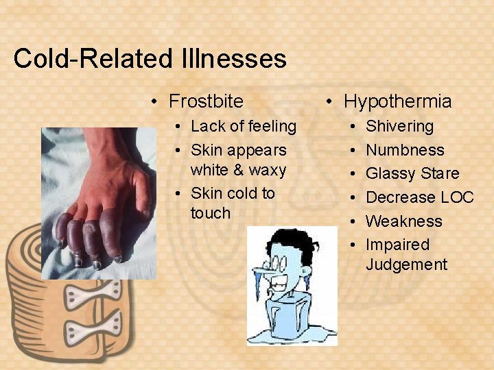 Cold-Related Illnesses • Frostbite • Lack of feeling • Skin appears white & waxy