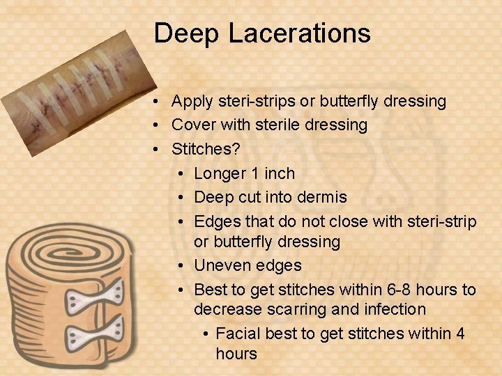 Deep Lacerations • Apply steri-strips or butterfly dressing • Cover with sterile dressing •