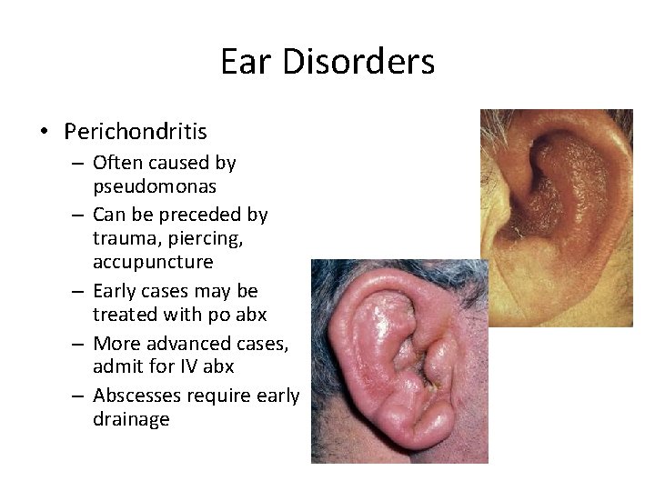 Ear Disorders • Perichondritis – Often caused by pseudomonas – Can be preceded by