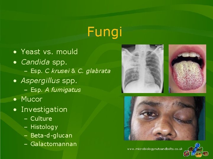 Fungi • Yeast vs. mould • Candida spp. – Esp. C krusei & C.