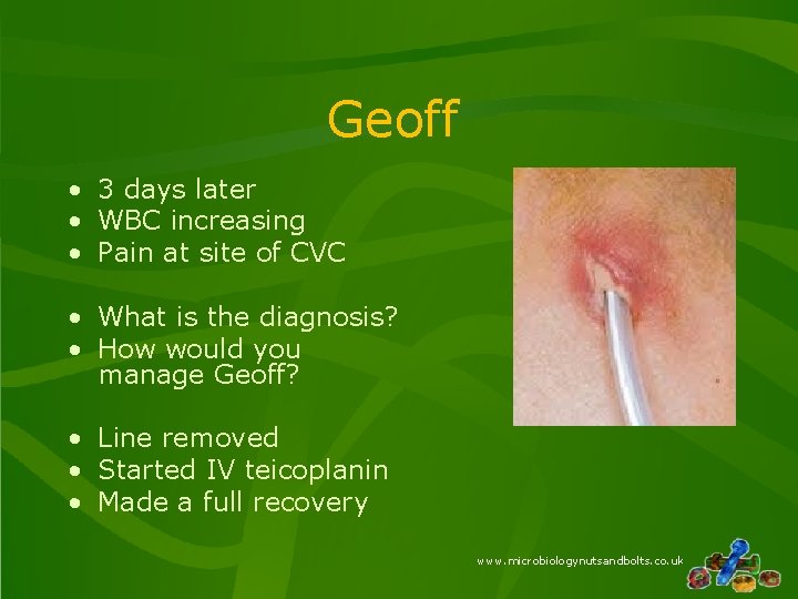 Geoff • 3 days later • WBC increasing • Pain at site of CVC