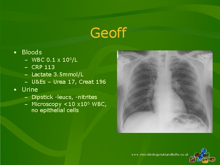 Geoff • Bloods – – WBC 0. 1 x 109/L CRP 113 Lactate 3.
