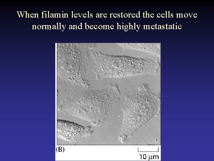 When filamin levels are restored the cells move normally and become highly metastatic 