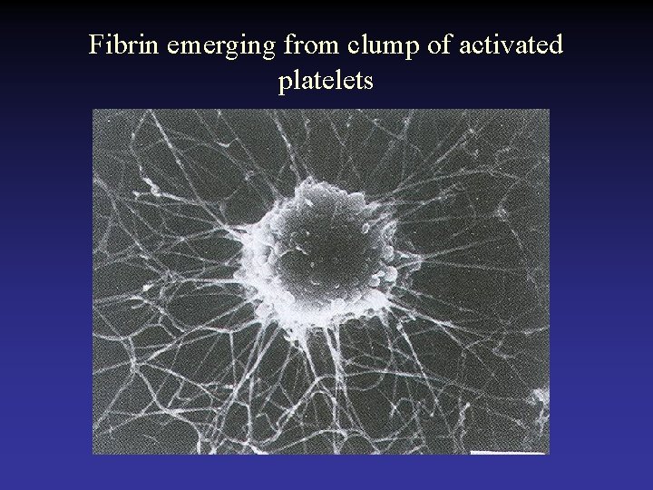 Fibrin emerging from clump of activated platelets 