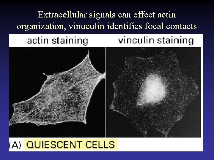 Extracellular signals can effect actin organization, vinuculin identifies focal contacts 