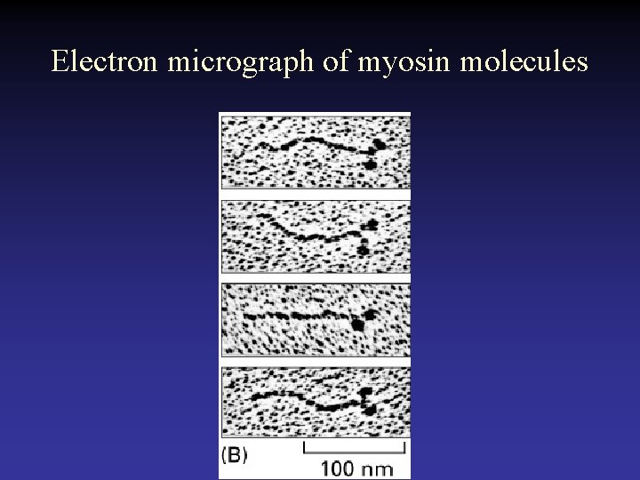 Electron micrograph of myosin molecules 