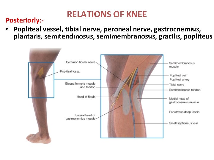 RELATIONS OF KNEE Posteriorly: • Popliteal vessel, tibial nerve, peroneal nerve, gastrocnemius, plantaris, semitendinosus,