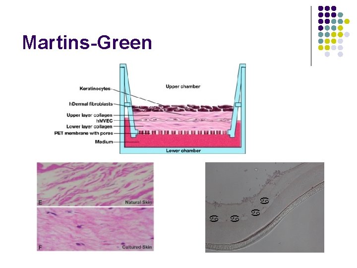 Martins-Green a a 