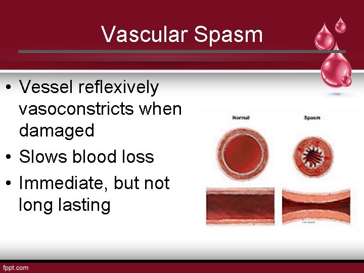Vascular Spasm • Vessel reflexively vasoconstricts when damaged • Slows blood loss • Immediate,