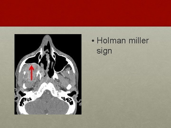  • Holman miller sign 